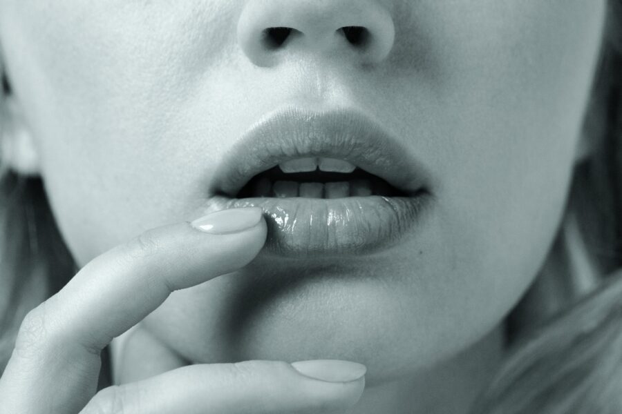 FILLMED- Art filler lips soft 1*1ml